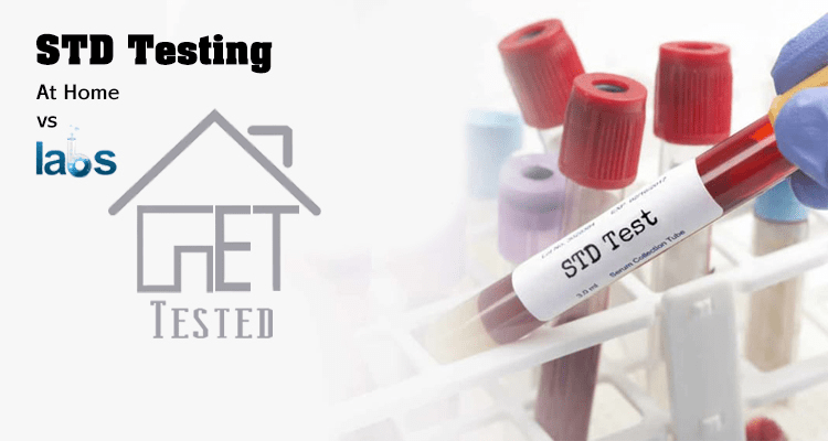 Std Testing At Home Or Lab-what’s Right For You?